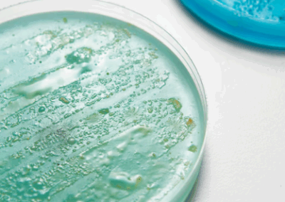 Microbiología los microorganismos, sus estructuras, fisiología, genética e inmunología